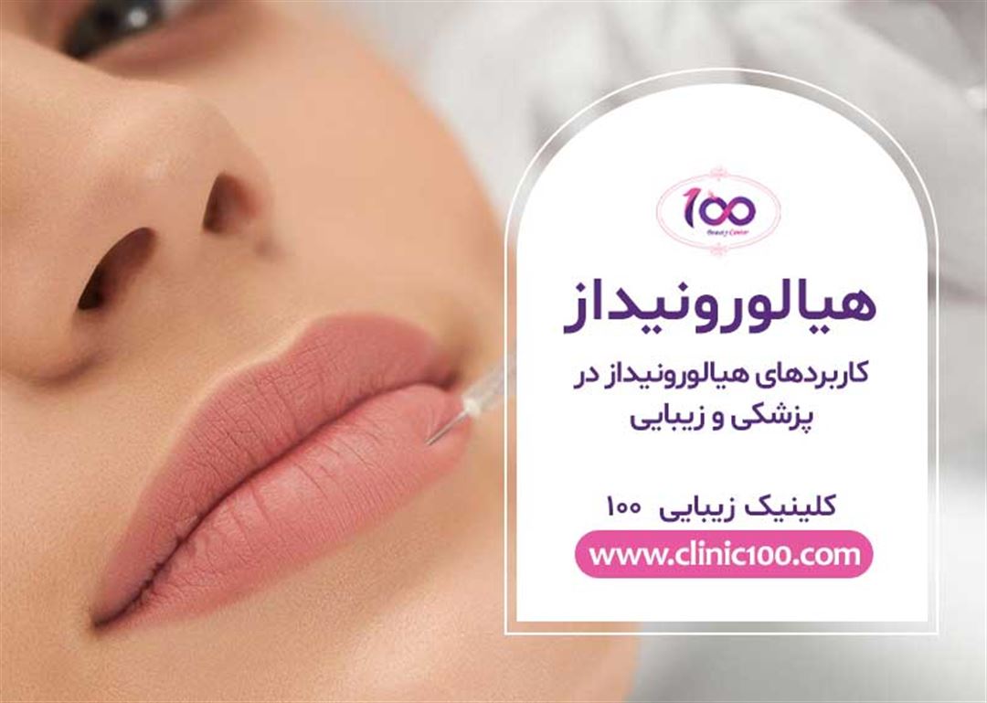 کاربردهای هیالورونیداز | مزایا و معایب تزریق هیالاز