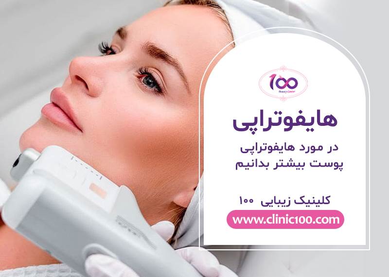 هزینه هایفوتراپی کرج _ دکتر خوب برای هایفو در کرج