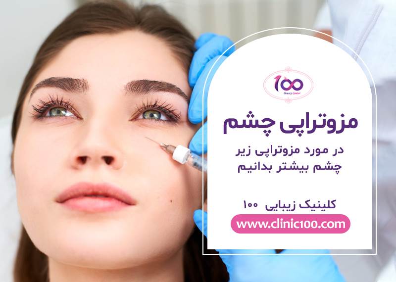 مزوتراپی زیر چشم | هزینه مزوتراپی زیر چشم