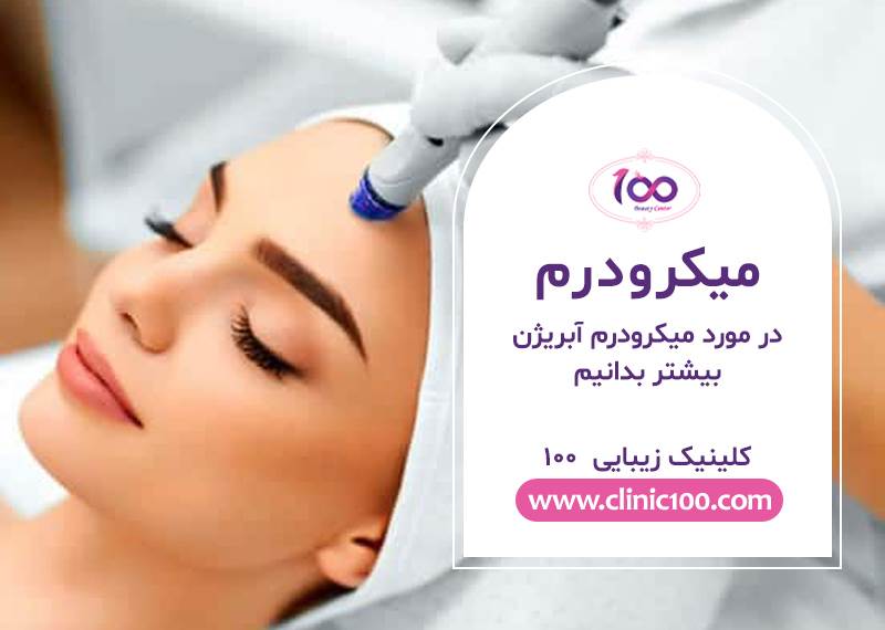 میکرودرم ابریژن در کرج