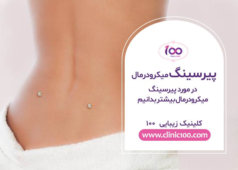 پیرسینگ میکرودرمال-کلینیک زیبایی 100