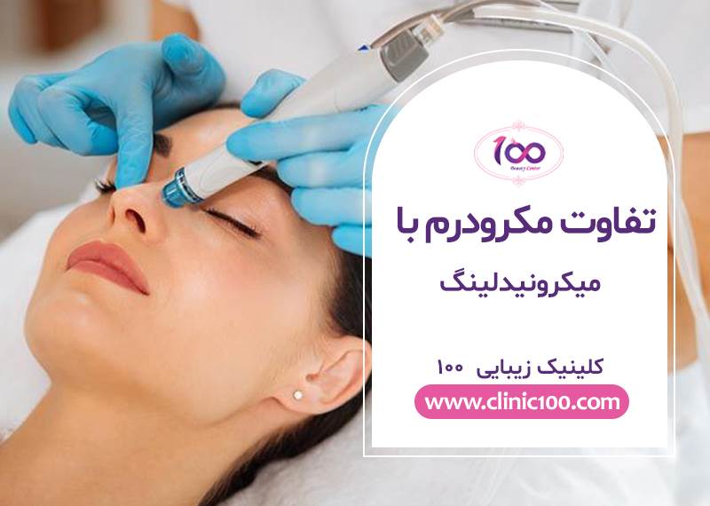 میکرودرم با میکرونیدلینگ-تفاوتها،کاربردها، مزایا و معایب