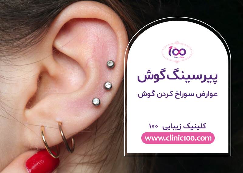 سوراخ کردن گوش چه عوارضی دارد-در مورد پیرسینگ گوش بیشتر بدانیم