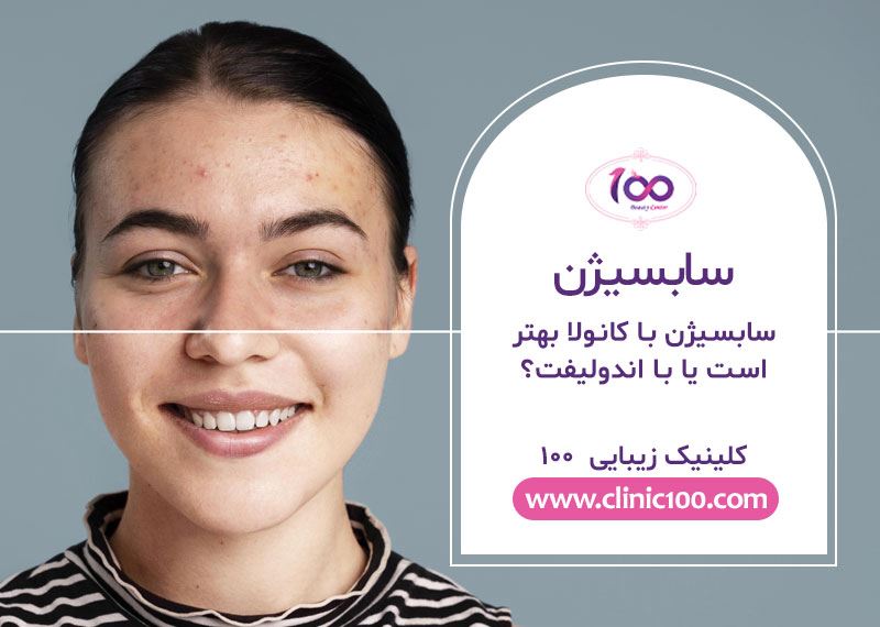 سابسیژن در کرج | هزینه سابسیژن در کرج
