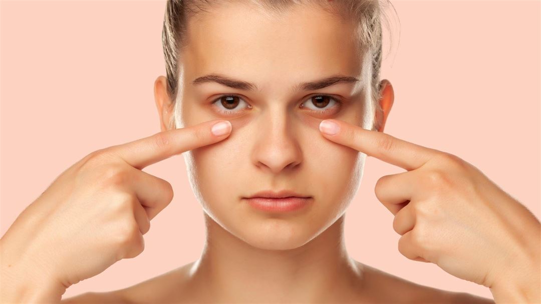 هزینه مزوتراپی گودی و تیرگی زیر چشم در کرج