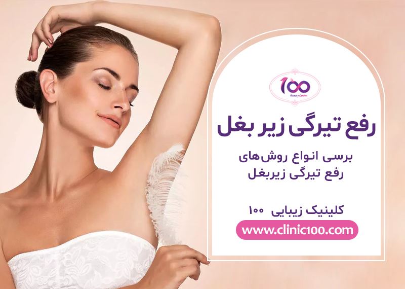 انواع روش های رفع تیرگی زیربغل