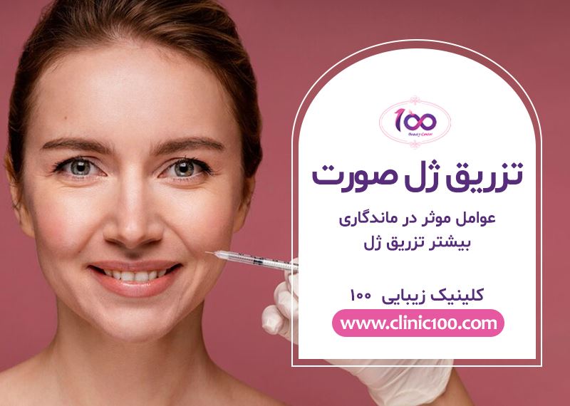 تزریق ژل به صورت چقدر ماندگاری دارد ؟