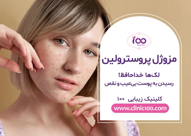 مزوژل پروسترولین ضد لک چیست؟
