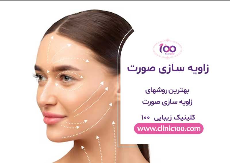 زاویه سازی صورت | بهترین دکتر زاویه سازی صورت در کرج