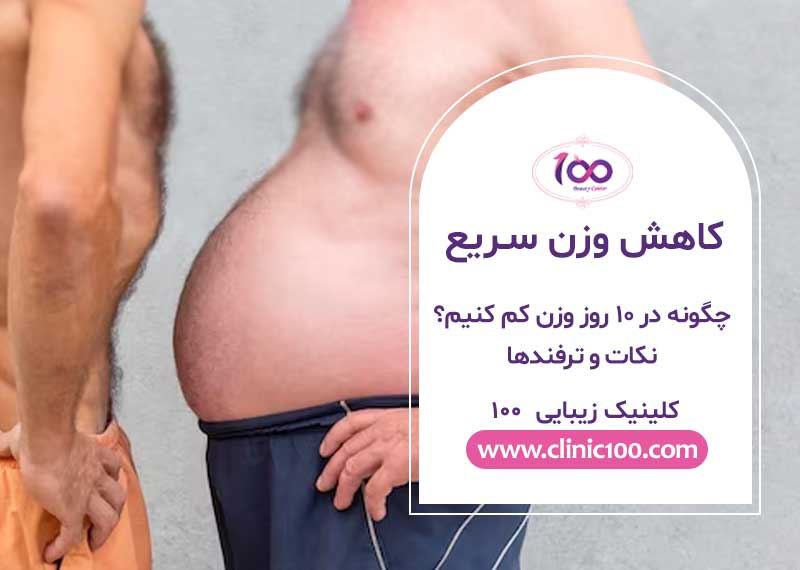 چگونه در 10 روز وزن کم کنیم؟ نکات و ترفندها