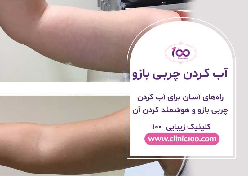 راههای آسان برای آب کردن چربی بازو و هوشمند کردن آنها