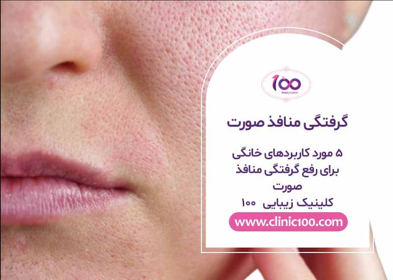 5 مورد کاربردهای خانگی برای رفع گرفتگی منافذ صورت